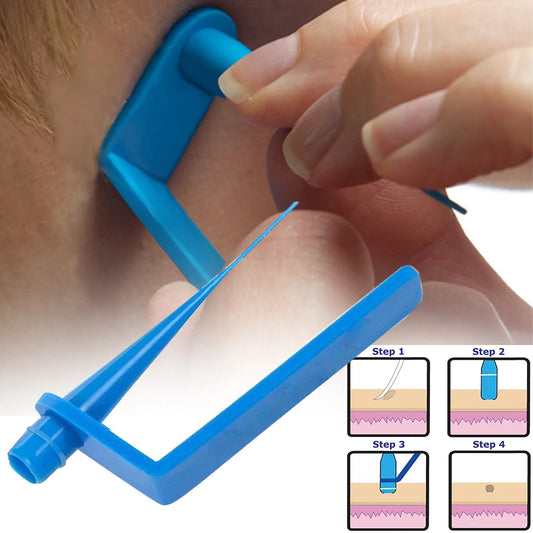 Papilloma Removal tool For Small To Medium Face Care blue Micro band Skin Tag Remover Kit Corn With Cleansing Swabs Mole Wart