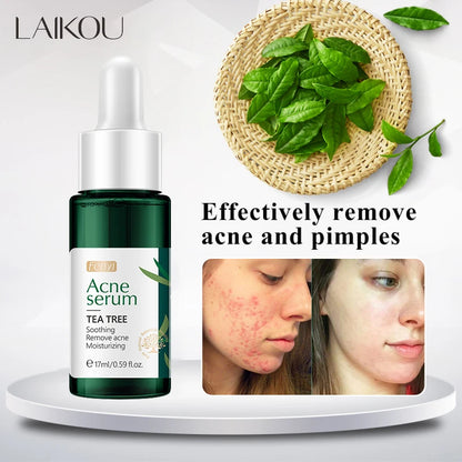 LAIKOU Tea Tree Anti-Acne Skin Care Set Acne Treatment Oil-Control Moisturizing Cleanser&Cream&Serum&Mud Mask Whiten Skin Care