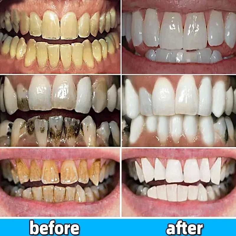 Whitening Teeth Toothpaste Dental Calculus stain Bad Breath  Remove  Brightening Preventing Periodontitis Dental Cleansing Care