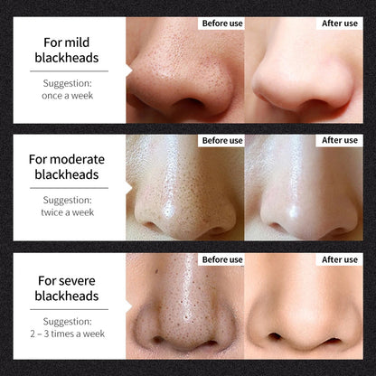 Blackhead Remover Mask Nasal Patch Deep Cleaning Skin Care Shrink Pores Acne Treatment Nose Mask Black Dot Pores Clean Strip