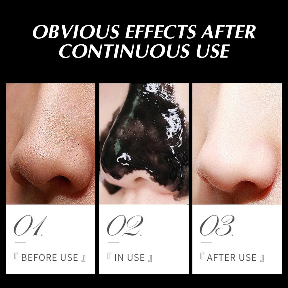 Blackhead Remover Mask Nasal Patch Deep Cleaning Skin Care Shrink Pores Acne Treatment Nose Mask Black Dot Pores Clean Strip