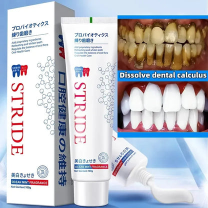 Whitening Teeth Toothpaste Dental Calculus stain Bad Breath  Remove  Brightening Preventing Periodontitis Dental Cleansing Care