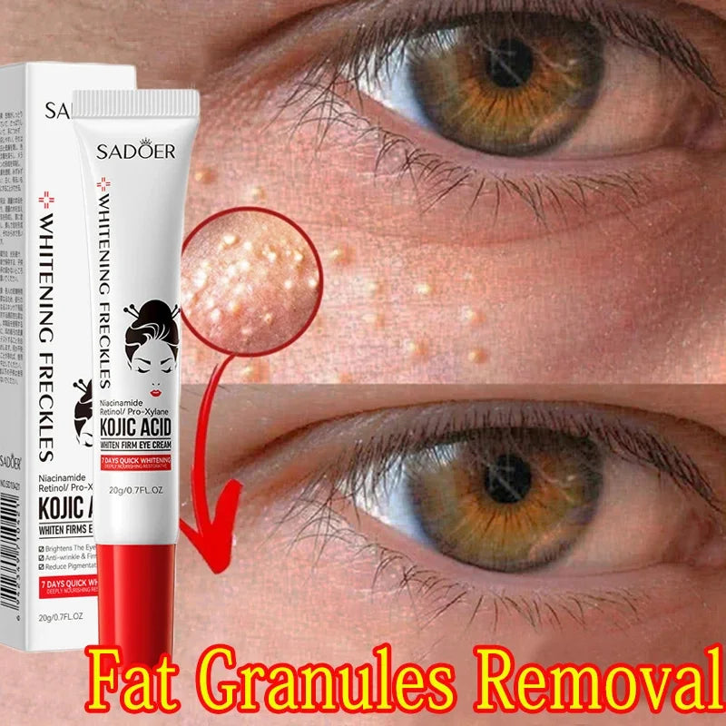 Fat Granules Remover Eye Cream Anti-Puffiness Anti Inflammatory Reduce Dark Circles Eyebags  Fade Lines Moisturizing Eye Care