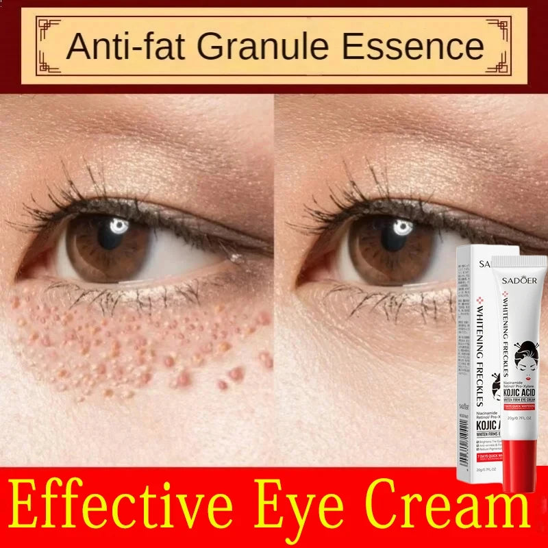 Fat Granules Remover Eye Cream Anti-Puffiness Anti Inflammatory Reduce Dark Circles Eyebags  Fade Lines Moisturizing Eye Care