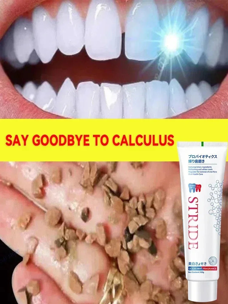 Whitening Teeth Toothpaste Dental Calculus Remover Fresh Breath Brightening Preventing Periodontitis Dental Cleansing Care New