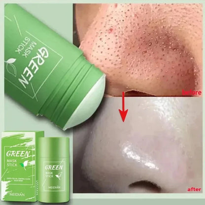 Dark Spots Remover Acne Skincare Solid Mask Green Tea Blackhead Blemish Clean Stick Cream Shrink Pores Pure Skin Exfoliator